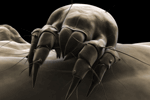 Human Scabies Image