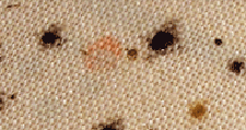 Matress Infestation closeup